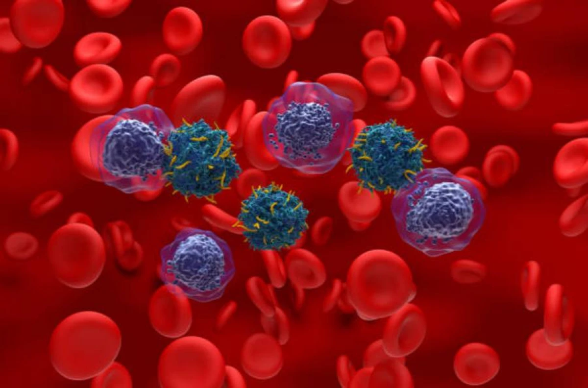 Aqressiv qan xərçənginin müalicəsində [[YENİLİK]]