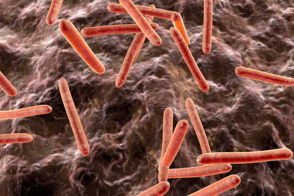 Britaniyada vərəmə [[yoluxma halları artır]]