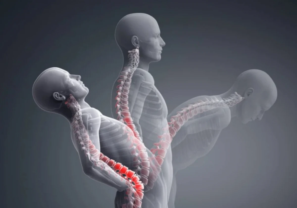 [[Xroniki bel ağrısının]] yeni səbəbi aşkar edildi