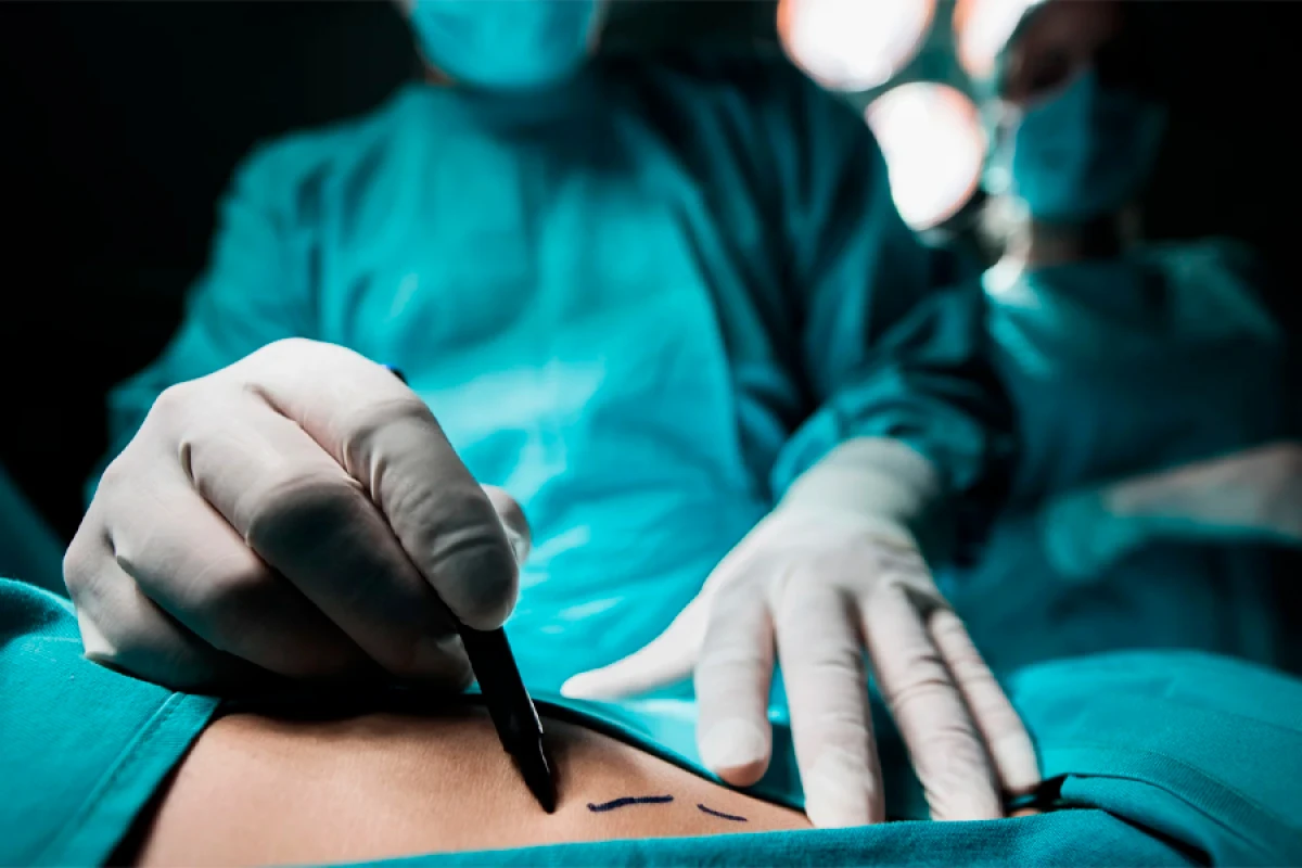 Xəstələri masada ölən həkimlərin [[SİYAHISI]]