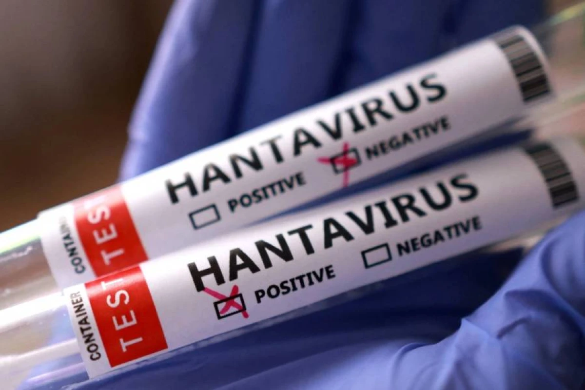 [[Hantavirus Kanadada da ortaya çıxdı]] - KİV