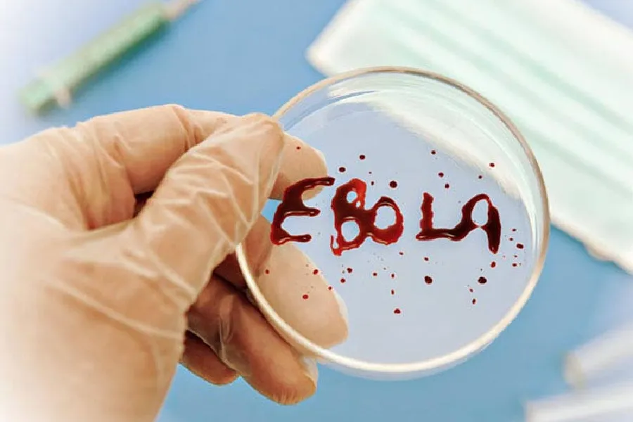 Konqoda Eboladan ölənlərin sayı 360 nəfərə çatdı