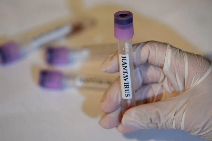 Ölümcül virus yayılır: Çilidə fövqəladə sanitariya həyəcanı elan edildi