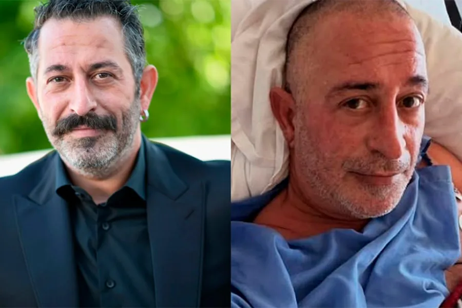 Cem Yılmazdan sonra gündəm oldu: Qulaqdakı bu xətt infarkt xəbərçisidir? - ŞOK
