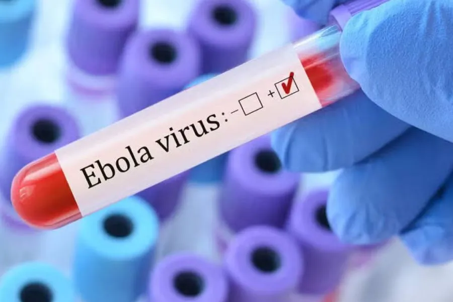 Eboladan ölənlərin sayı 4700-ü keçdi